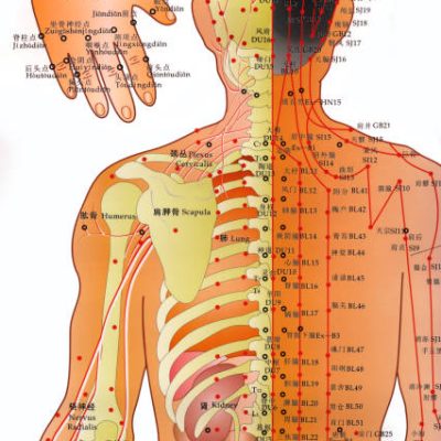 York.England.06.08.13. Acupuncture - a system of complementary medicine that involves pricking the skin with needles. Used to alleviate pain and treat various physical, mental and emotional conditions